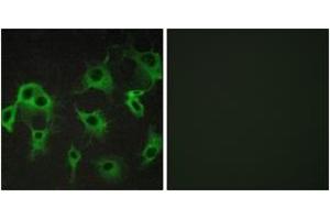 Immunofluorescence analysis of COS7 cells, using ADRB2 Antibody. (beta 2 Adrenergic Receptor anticorps  (AA 336-385))