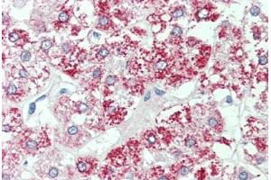 Anti-SLC7A2 antibody  ABIN1049350 IHC staining of human adrenal.