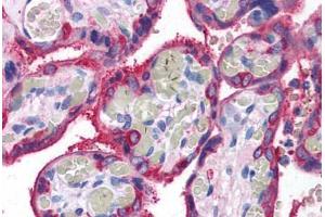 Human Placenta (formalin-fixed, paraffin-embedded) stained with TGM2 antibody ABIN307194 at 5 ug/ml followed by biotinylated goat anti-rabbit IgG secondary antibody ABIN481713, alkaline phosphatase-streptavidin and chromogen. (Transglutaminase 2 anticorps)