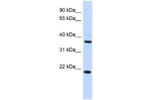 TMEM74 antibody used at 1 ug/ml to detect target protein. (TMEM74 anticorps  (Middle Region))