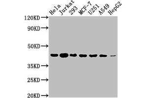 Western Blot Positive WB detected in: Hela whole cell lysate, Jurkat whole cell lysate, 293 whole cell lysate, MCF-7 whole cell lysate, U251 whole cell lysate, A549 whole cell lysate, HepG2 whole cell lysate All lanes: AURKB antibody at 1:2000 Secondary Goat polyclonal to rabbit IgG at 1/50000 dilution Predicted band size: 40, 36, 17, 35 kDa Observed band size: 40 kDa