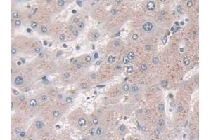 Detection of ASAH1 in Human Liver Tissue using Polyclonal Antibody to N-Acylsphingosine Amidohydrolase 1 (ASAH1)