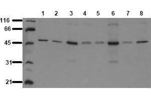 Western Blotting (WB) image for anti-Glycogen Synthase Kinase 3 alpha (GSK3a) antibody (ABIN126803) (GSK3 alpha anticorps)