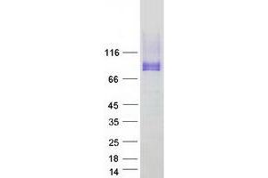 Validation with Western Blot