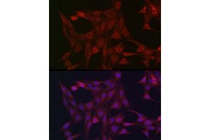 Immunofluorescence analysis of NIH/3T3 cells using [KO Validated] ST Rabbit pAb (ABIN6132553, ABIN6148568, ABIN6148571 and ABIN6215503) at dilution of 1:100 (40x lens).