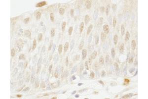 Immunohistochemistry (IHC) image for anti-Myb-Binding Protein 1A (MYBBP1A) (AA 450-500) antibody (ABIN7448678) (MYBBP1A anticorps  (AA 450-500))