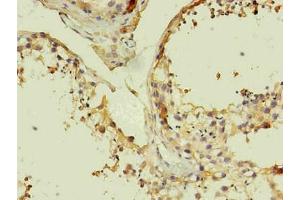 Immunohistochemistry of paraffin-embedded human testis using ABIN7140933 in 30 μg/mL dilute concentrations. (CD14 anticorps)