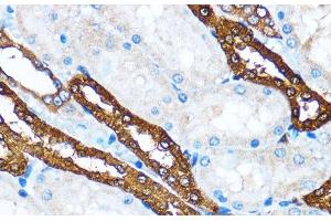 Immunohistochemistry of paraffin-embedded Rat kidney using PIK3CA Polyclonal Antibody at dilution of 1:100 (40x lens). (PIK3CA anticorps)