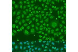 Immunofluorescence analysis of U2OS cells using HNRNPR Polyclonal Antibody at dilution of 1:100. (HNRNPR anticorps)