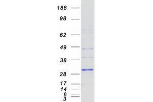 Validation with Western Blot