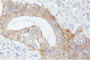 anti-Spectrin Beta, Non-Erythrocytic 1 (SPTBN1) (AA 2150-2200) antibody