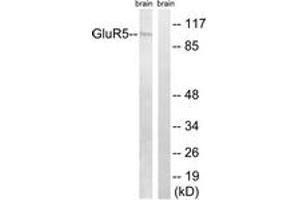 Western blot analysis of extracts from mouse brain cells, using GluR5 Antibody. (GRIK1 anticorps  (AA 10-59))