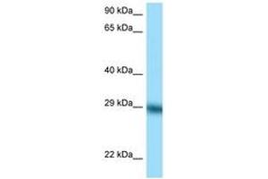 Image no. 1 for anti-Tissue Factor Pathway Inhibitor (Lipoprotein-Associated Coagulation Inhibitor) (TFPI) (C-Term) antibody (ABIN6748178)