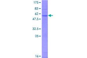 Image no. 1 for Cholesterol 25-Hydroxylase (CH25H) (AA 1-272) protein (GST tag) (ABIN1349261)