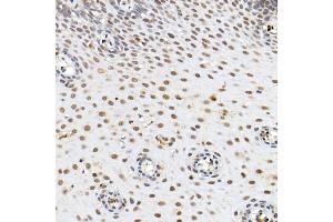 Immunohistochemistry of paraffin-embedded mouse lung using α-Smooth Muscle Actin  Rabbit pAb (ABIN6127402, ABIN6136473, ABIN6136476 and ABIN6214239) at dilution of 1:25 (40x lens).