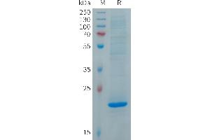 Human Protein, His Tag on SDS-PAGE under reducing condition.