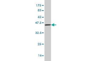 Western Blot detection against Immunogen (37.
