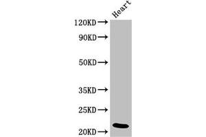Western Blot Positive WB detected in: Rat heart tissue All lanes: NDUFB9 antibody at 4 μg/mL Secondary Goat polyclonal to rabbit IgG at 1/50000 dilution Predicted band size: 22 kDa Observed band size: 22 kDa (NDUFB9 anticorps  (AA 50-179))