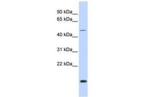 Image no. 1 for anti-Forkhead Box N3 (FOXN3) (AA 396-445) antibody (ABIN6742323) (FOXN3 anticorps  (AA 396-445))