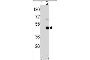 Western blot analysis of GEA9 (arrow) using rabbit polyclonal GEA9 Antibody  (ABIN390111 and ABIN2840622). (MAGEA9 anticorps  (AA 171-198))