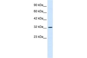 Western Blotting (WB) image for anti-SWI/SNF Related, Matrix Associated, Actin Dependent Regulator of Chromatin, Subfamily A, Member 2 (SMARCA2) antibody (ABIN2460965) (SMARCA2 anticorps)