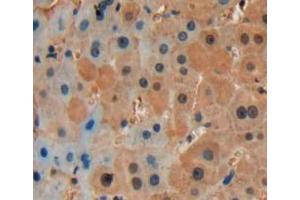 Used in DAB staining on fromalin fixed paraffin-embedded liver tissue