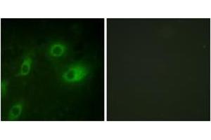 Immunofluorescence analysis of HeLa cells, using Keratin 18 (Phospho-Ser52) Antibody. (Cytokeratin 18 anticorps  (pSer52))