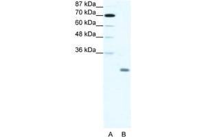 Western Blotting (WB) image for anti-Inhibitor of DNA Binding 4, Dominant Negative Helix-Loop-Helix Protein (ID4) antibody (ABIN2461635)