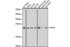 Western blot analysis of extracts of various cell lines, using RAB2A antibody. (RAB2A anticorps  (AA 1-212))