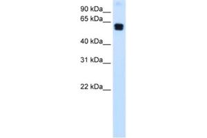 Western Blotting (WB) image for anti-Docking Protein 1, 62kDa (Downstream of tyrosine Kinase 1) (DOK1) antibody (ABIN2463701) (DOK1 anticorps)