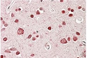 AP23695PU-N STK39 / SPAK Antibody staining of paraffin embedded Human Cerebral Cortex at 3. (STK39 anticorps  (Internal Region))