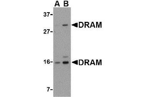 Western blot analysis of DRAM in 293 cell lysate with AP30304PU-N DRAM antibody at (A) 0. (DRAM anticorps  (C-Term))