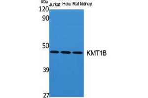 Western Blot (WB) analysis of specific cells using KMT1B Polyclonal Antibody. (SUV39H2 anticorps  (Internal Region))