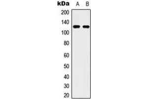 Western blot analysis of ULK2 expression in Hela (A), HepG2 (B) whole cell lysates. (ULK2 anticorps  (C-Term))