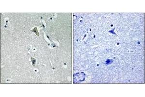 Immunohistochemistry analysis of paraffin-embedded human brain, using PKC thet (Phospho-Thr538) Antibody.