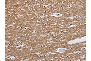 The image on the left is immunohistochemistry of paraffin-embedded Human brain tissue using ABIN7191592(NCR2 Antibody) at dilution 1/60, on the right is treated with synthetic peptide. (NKp44/NCR2 anticorps)