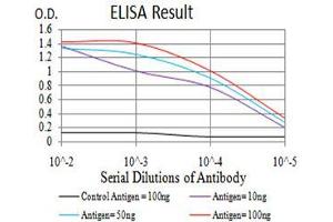 Black line: Control Antigen (100 ng),Purple line: Antigen (10 ng), Blue line: Antigen (50 ng), Red line:Antigen (100 ng) (RAN anticorps  (AA 1-216))