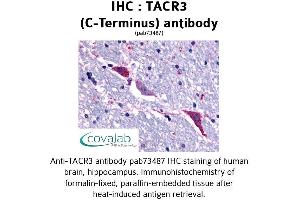 Image no. 1 for anti-Tachykinin Receptor 3 (TACR3) (C-Term), (Cytoplasmic Domain) antibody (ABIN1739880) (TACR3 anticorps  (C-Term, Cytoplasmic Domain))