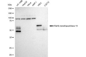 Western blotting analysis using Matrix metallopeptidase 14 antibody (ABIN7799340). (Recombinant MMP14 anticorps)