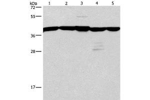 Western Blot analysis of A172 and 293T cell, Mouse kidney tissue, Human testis and brain malignant glioma tissue using GNA13 Polyclonal Antibody at dilution of 1:600 (GNA13 anticorps)