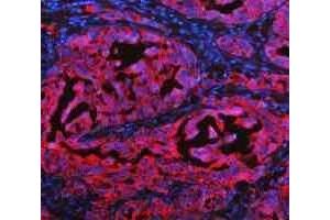 IF analysis of Cytokeratin 20/Krt20 using anti-Cytokeratin 20/Krt20 antibody (ABIN7601133). (KRT20 anticorps  (AA 29-431))