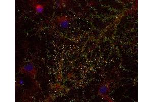 Indirect immunostaining of PFA fixed rat hippocampus neurons with anti-DAP 4 (dilution 1 : 500; green) and mouse anti-synapsin 1 (cat.