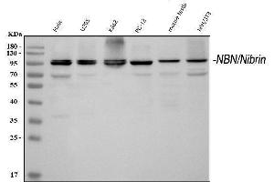 Western blot analysis of p95 NBS1 using anti-p95 NBS1 antibody (ABIN3043282). (Nibrin anticorps  (C-Term))