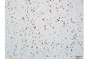 Formalin-fixed and paraffin embedded human brain labeled with Anti-HDAC2, Unconjugated (ABIN734813) followed by conjugation to the secondary antibody and DAB staining (HDAC2 anticorps  (AA 391-488))