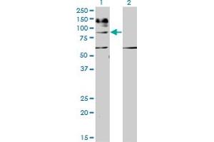 Western Blot analysis of IL31RA expression in transfected 293T cell line by IL31RA monoclonal antibody (M01), clone 3A10.