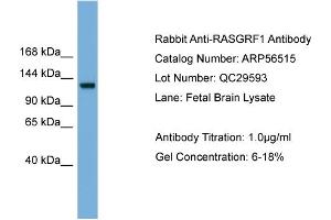 WB Suggested Anti-RASGRF1  Antibody Titration: 0. (RASGRF1 anticorps  (Middle Region))