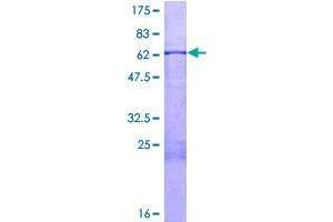 Image no. 1 for Stomatin (EPB72)-Like 2 (STOML2) (AA 1-356) protein (GST tag) (ABIN1321732)