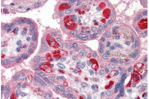 Human Placenta (formalin-fixed, paraffin-embedded) stained with PLTP antibody ABIN337143 at 1:100 followed by biotinylated goat anti-rabbit IgG secondary antibody ABIN481713, alkaline phosphatase-streptavidin and chromogen. (PLTP anticorps)