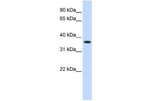 WB Suggested Anti-ZNF444 Antibody Titration:  0. (ZNF444 anticorps  (Middle Region))