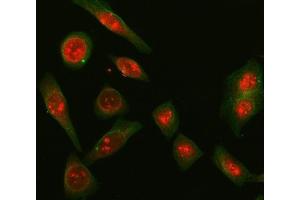 IF analysis of SNRPD2 and Tubulin beta using anti-SNRPD2 antibody (ABIN7598963) and anti-Tubulin beta antibody (ABIN7602744). (SNRPD2 anticorps  (AA 1-118))